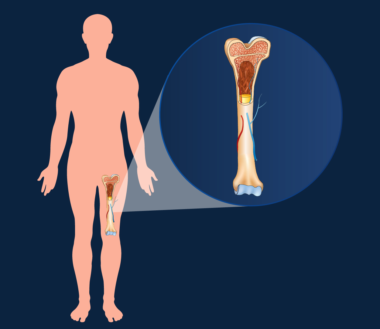 Bone Marrow